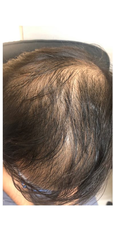 Before treatment